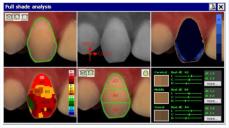 Software spectroshade