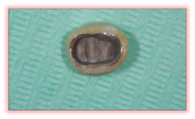 Spalla in ceramica